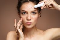 acne-treatment-on-skin.jpg